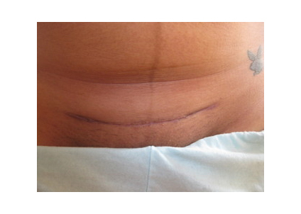 Ů���ʸ�����Ķ�Ƥ �Ҳ��̶�